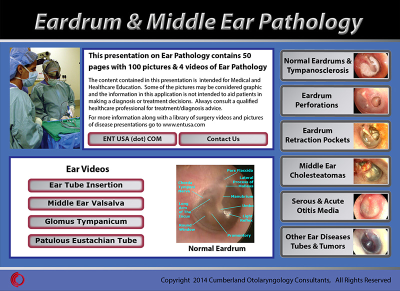 Eardrum & Middle Ear Pathology