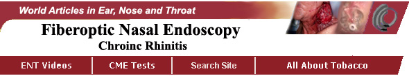 Fiberoptic Nasal Endoscopy Chronic Rhinitis