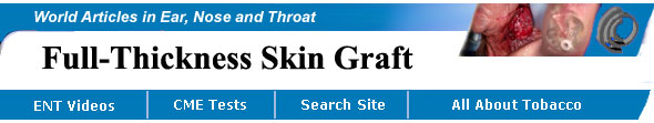 Full Thickness Skin Graft to Ear, Skin Cancer, Kevin Kavanagh