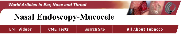 Nasal endoscopy - Drainage of Maxillary Sinus Mucocele