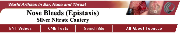 Nose Bleeds - Epistaxis - Silver Nitrate Cautery