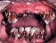 1. methamphetamine and dental caries