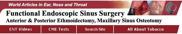 Functional Endoscopic Sinus Surgery, FESS, Anterior Posterior Ethmoidectomy and Maxillary Sinus Ethmoidectomy