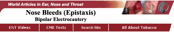 Nose Bleeds - Epistaxis - Bipolar Electrocautery