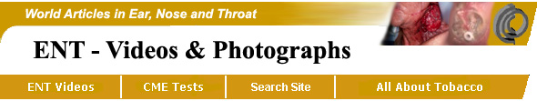 Ear Nose and Throat Photographx and Videos
