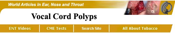 Vocal Cord Polyps